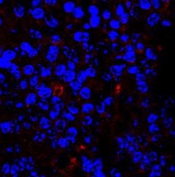 Les cellules de la rate sont marquées en bleu, les bactéries en rouge.