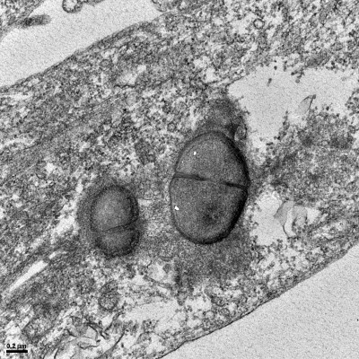 Microscopie électronique en transmission (MET) montrant des bactéries en division (Staphylococcus aureus) dans le cytoplasme de cellules musculaires en culture.