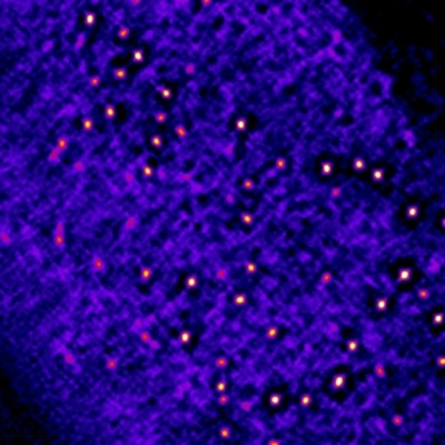 Nanodomaines observés par microscopie à super-résolution © Vincent Bayle
