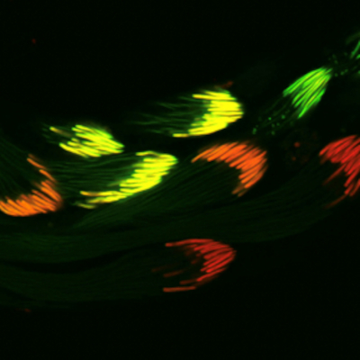 Spermatides de drosophiles en microscopie confocale - B. Loppin