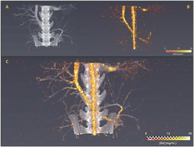 Images obtenues avec les fluorures de Gadolinium au SPCCT (abdomen de rat) ; Image A : scanner classique ; Image B : scanner SPCCT ; Image C : association des images A et B.