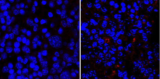 Les cellules de la rate sont marquées en bleu, les bactéries en rouge.