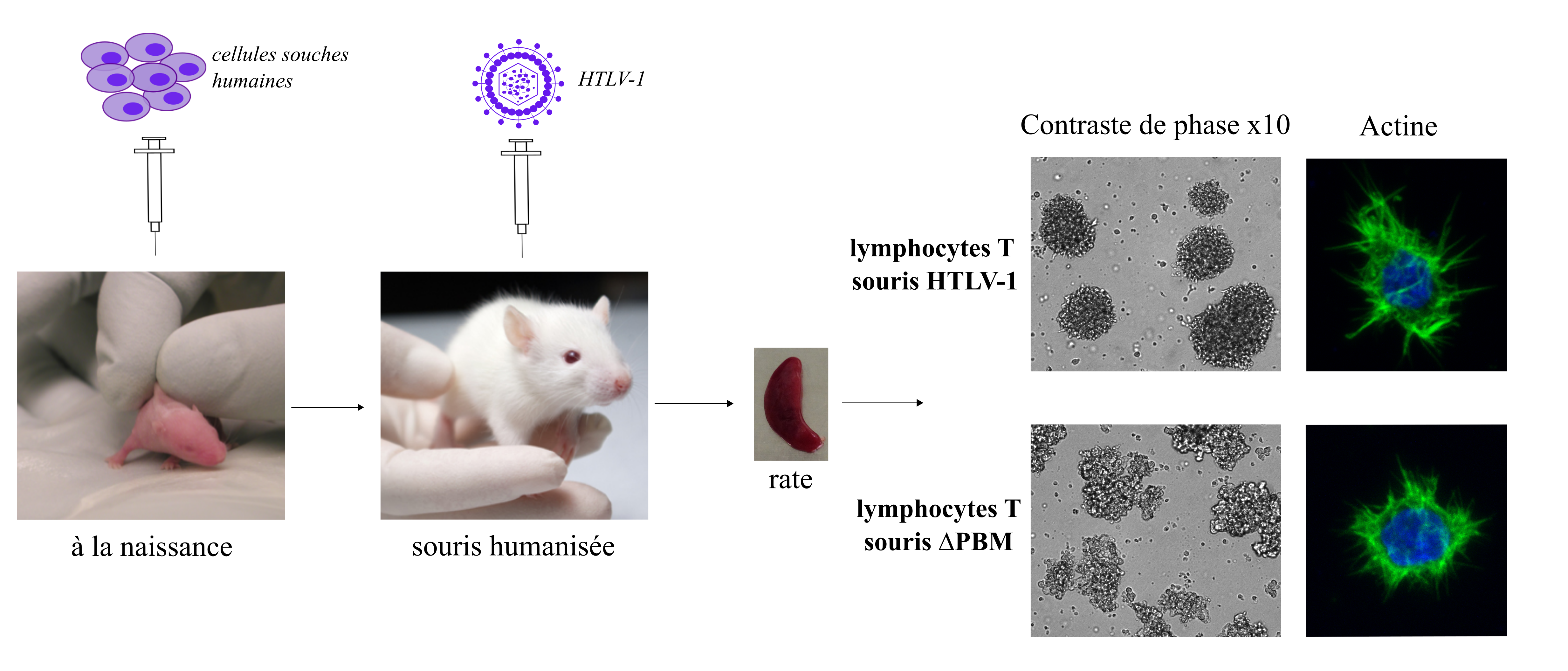 Les lymphocytes T isolés à partir de la rate des souris humanisées infectées par HTLV-1 ∆PBM forment des amas irréguliers en culture et sont de forme ronde.