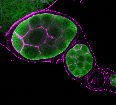 Chaîne de follicules ovariens de drosophile à différents stades