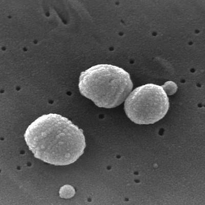 Streptococcus pneumoniae © Wikipédia