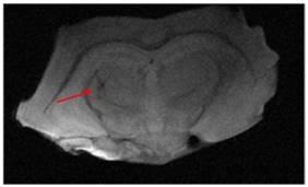 Brain MRI