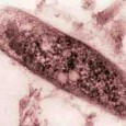   A 100 node sensor network was deployed at the Bichât Hospital to measure the exposure of the medical staff to the agent of tuberculosis: the tubercle bacillus, Mycobacterium tuberculosis. After […]