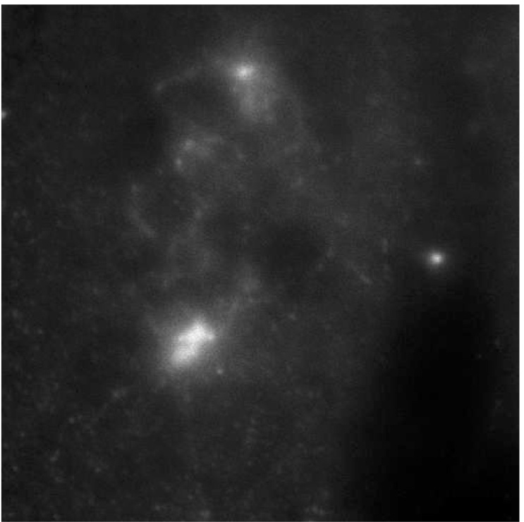 Inverse problems in imaging