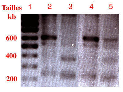 Analyse lectrophorse gel d'agarose