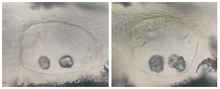 Otolithes