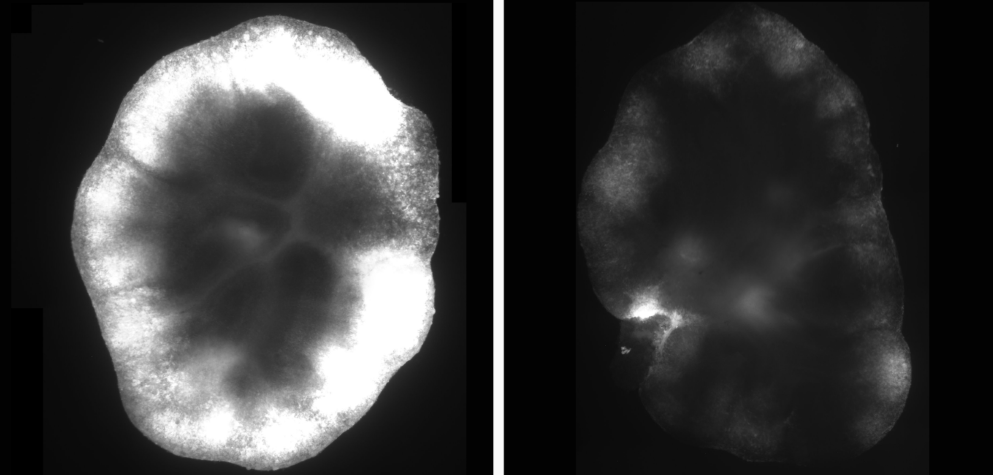  Microscopie à fluorescence d’une coupe de cervelet de hamster infectée par le virus Nipah