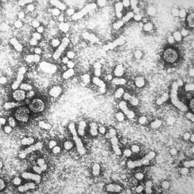 Virus de l'hépatite B