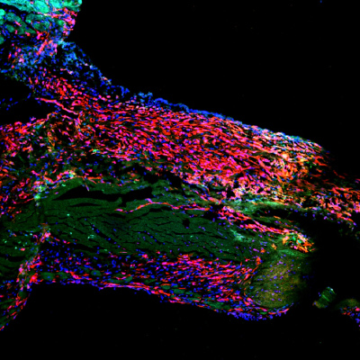 Image de cellules du coeur