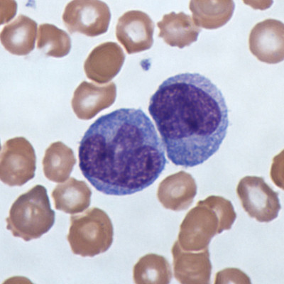 Monocytes