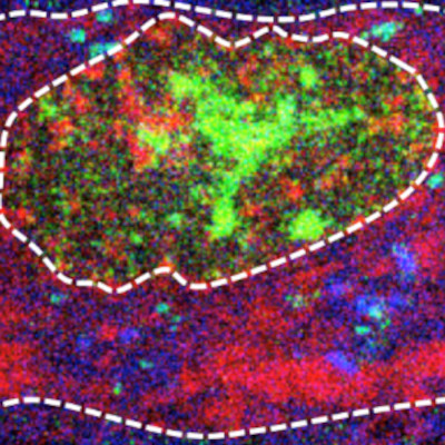 Image de la composition en P/Fe/S d’une coupe de neurone de la substantia nigra. Le corps du neurone et de son noyau sont contourés par une ligne en tiretés. Des granules cytosoliques riches en fer et en soufre sont pointées par des flèches. 
