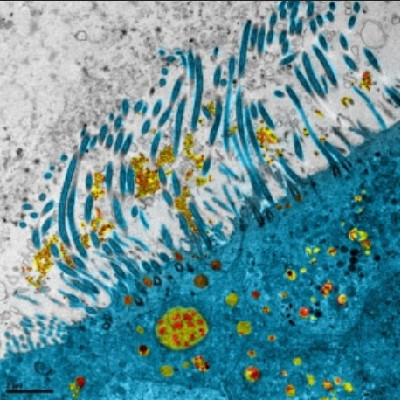 Epithélium respiratoire humain infecté par le SARS-CoV-2. © Manuel Rosa-Calatrava, Inserm; Olivier Terrier CNRS; Andrés Pizzorno Signia Therapeutics; Elisabeth Errazuriz-Cerda UCBL1 CIQLE. VirPath (Centre International de Recherche en Infectiologie U1111 INSERM - UMR 5308 CNRS - ENS Lyon - UCBL1)
