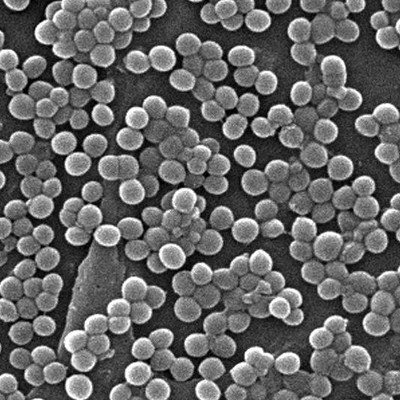 Staphylococcus aureus