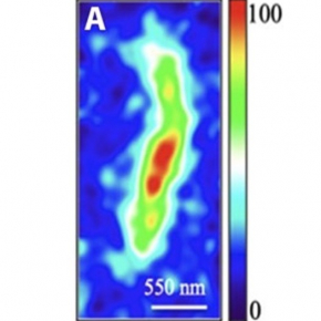 Nickel dans les filaments kérogeniques. 